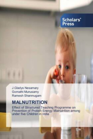 Knjiga MALNUTRITION Gomathi Munusamy