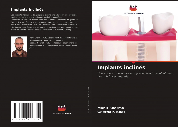 Book Implants inclinés Geetha K Bhat