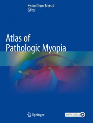 Könyv Atlas of Pathologic Myopia 