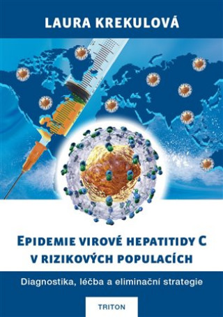 Carte Epidemie virové hepatitidy C v rizikových populací Laura Krekulová