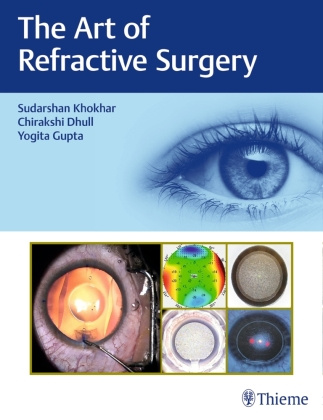 Könyv The Art of Refractive Surgery Chirakshi Dhull