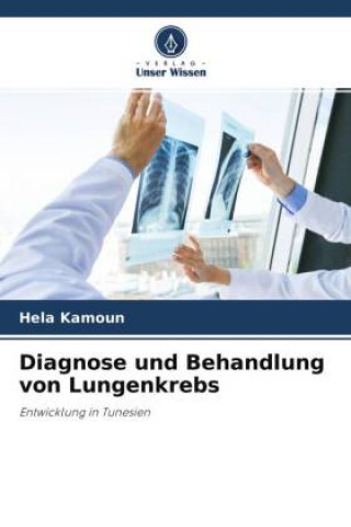 Kniha Diagnose und Behandlung von Lungenkrebs 