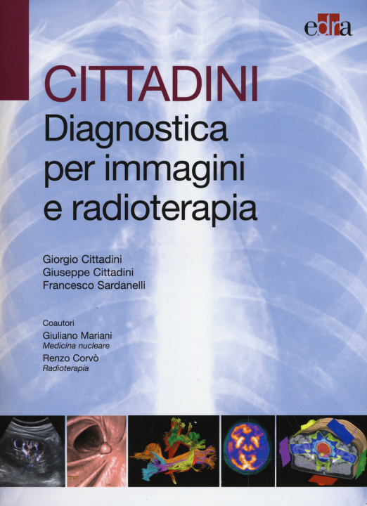 Книга Cittadini. Diagnostica per immagini e radioterapia Giorgio Cittadini