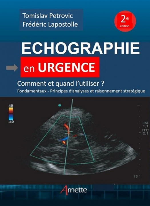 Knjiga Echographie en urgence Lapostolle