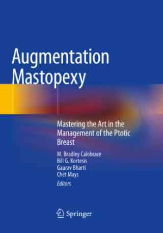Kniha Augmentation Mastopexy Chet Mays