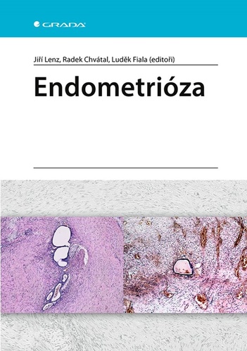 Kniha Endometrióza Lenz Jiří