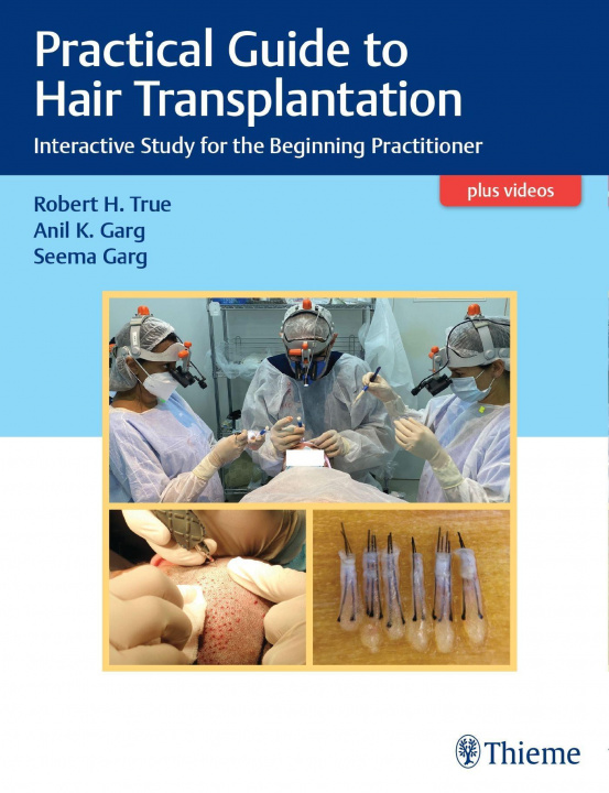 Carte Practical Guide to Hair Transplantation 