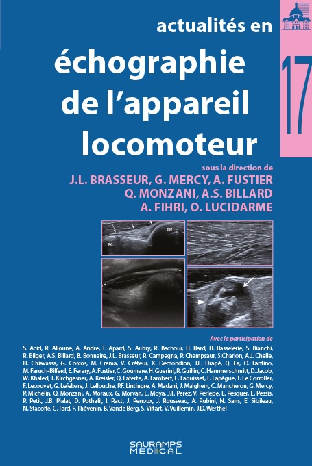 Könyv ACTUALITES EN ECHOGRAPHIE DE L APPAREIL LOCOMOTEUR T 17 BRASSEUR/MERCK & COLL