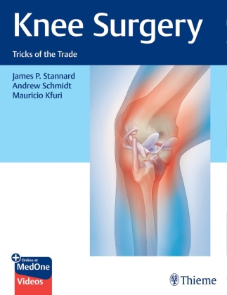 Knjiga Knee Surgery Andrew Schmidt