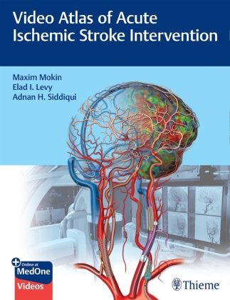 Carte Video Atlas of Acute Ischemic Stroke Intervention Elad Levy