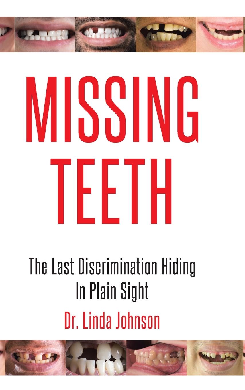 Knjiga Missing Teeth 
