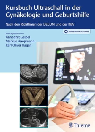 Kniha Kursbuch Ultraschall in der Gynäkologie und Geburtshilfe Markus Hoopmann