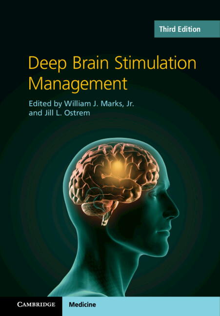 Book Deep Brain Stimulation Management WILLIAM J. MARKS