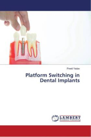 Boek Platform Switching in Dental Implants Preeti Yadav