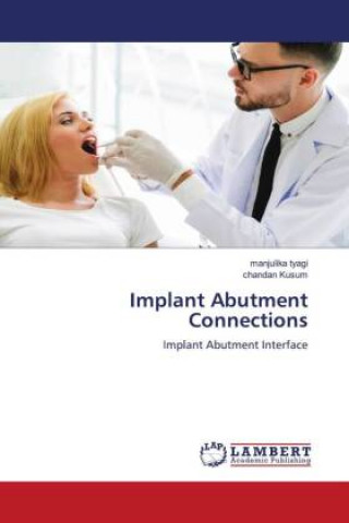 Carte Implant Abutment Connections Chandan Kusum
