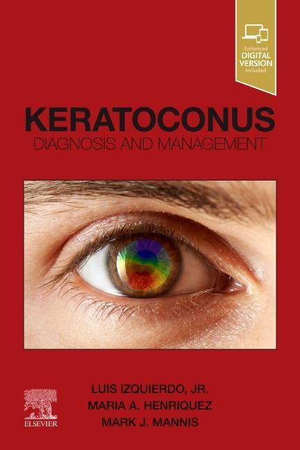 Książka Keratoconus Luis Izquierdo