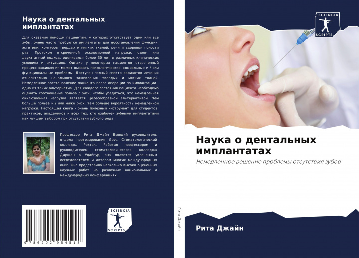 Книга Nauka o dental'nyh implantatah 