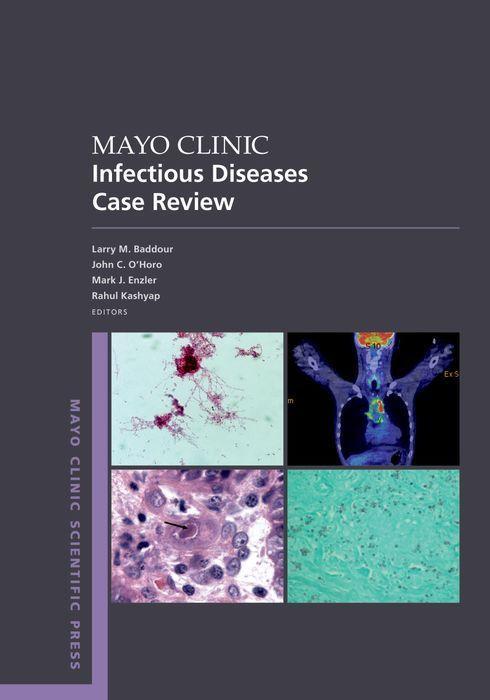 Kniha Mayo Clinic Infectious Disease Case Review 