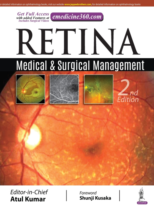 Knjiga Retina Atul Kumar