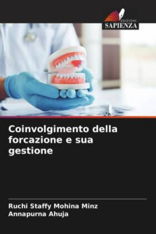 Knjiga Coinvolgimento della forcazione e sua gestione Annapurna Ahuja