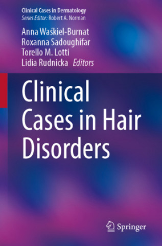 Kniha Clinical Cases in Hair Disorders 