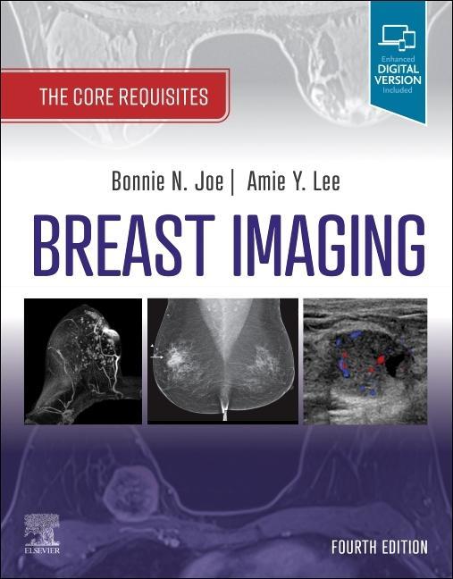 Книга Breast Imaging Bonnie N. Joe