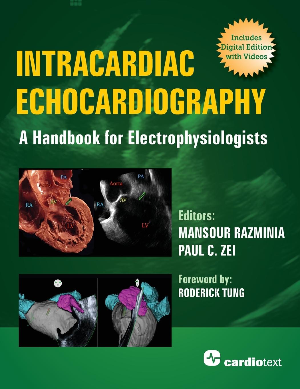 Книга Intracardiac Echocardiography: A Handbook for Electrophysiologists Paul C. Zei