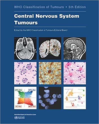 Carte Central Nervous System Tumours: Who Classification of Tumours 