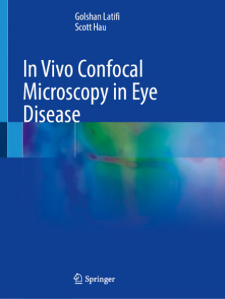 Livre In Vivo Confocal Microscopy in Eye Disease Golshan Latifi