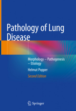 Könyv Pathology of Lung Disease Helmut Popper
