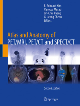 Könyv Atlas and Anatomy of PET/MRI, PET/CT and SPECT/CT E. Edmund Kim