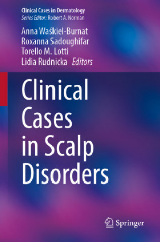 Könyv Clinical Cases in Scalp Disorders Anna Waskiel-Burnat