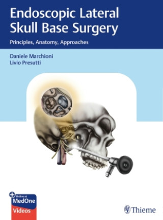 Kniha Endoscopic Lateral Skull Base Surgery Daniele Marchioni