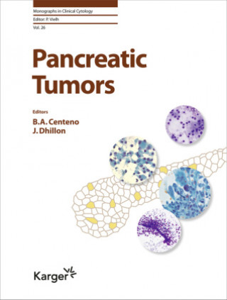 Kniha Pancreatic Tumors Barbara A. Centeno