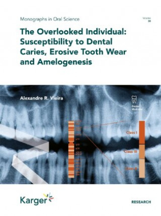 Livre The Overlooked Individual: Susceptibility to Dental Caries, Erosive Tooth Wear and Amelogenesis Alexandre Rezende Vieira