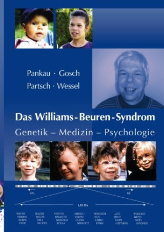 Livre Das Williams-Beuren-Syndrom Armin Wessel