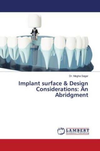Knjiga Implant surface & Design Considerations: An Abridgment Dr. Megha Sagar