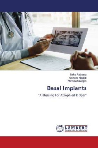 Buch Basal Implants Archana Nagpal