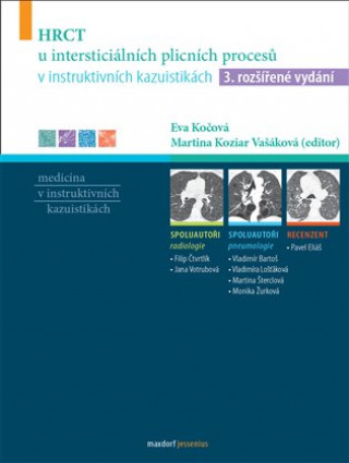 Książka HRCT u intersticiálních plicních procesů v instruktivních kazuistikách Eva Kočová;  Martina Vašáková