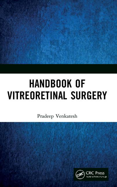 Kniha Handbook of Vitreoretinal Surgery Venkatesh