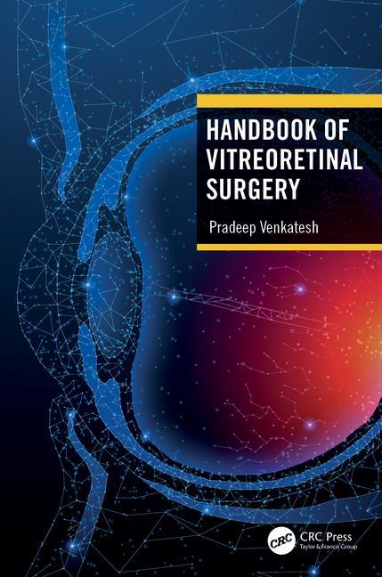 Kniha Handbook of Vitreoretinal Surgery Venkatesh