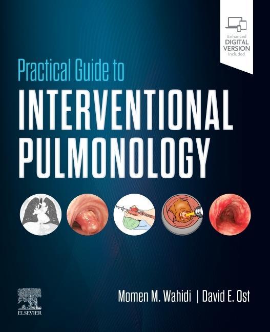 Książka Practical Guide to Interventional Pulmonology Momen M Wahidi