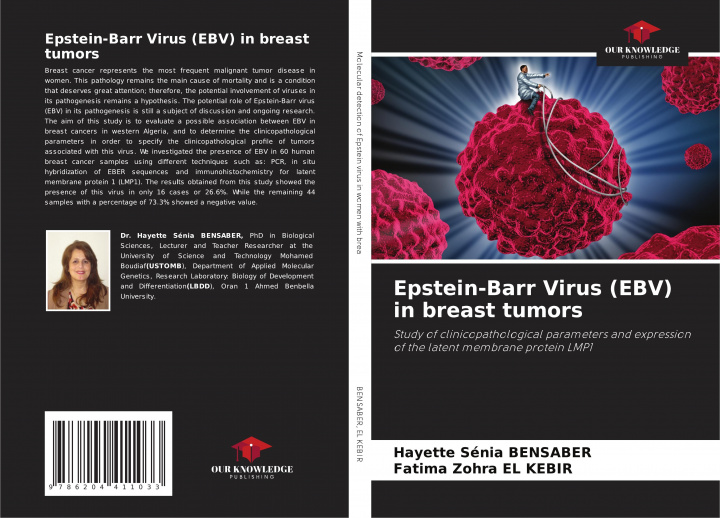 Książka Epstein-Barr Virus (EBV) in breast tumors Fatima Zohra El Kebir