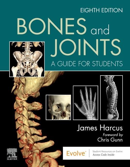 Carte Bones and Joints JAMES HARCUS