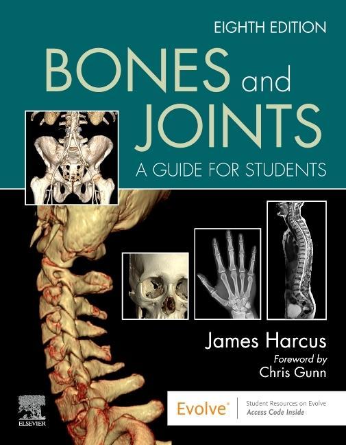 Kniha Bones and Joints JAMES HARCUS