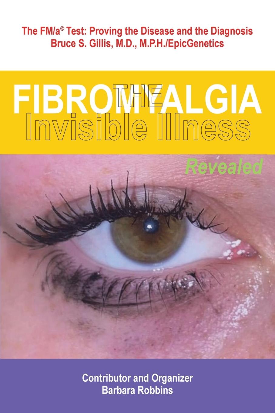 Kniha Fibromyalgia 