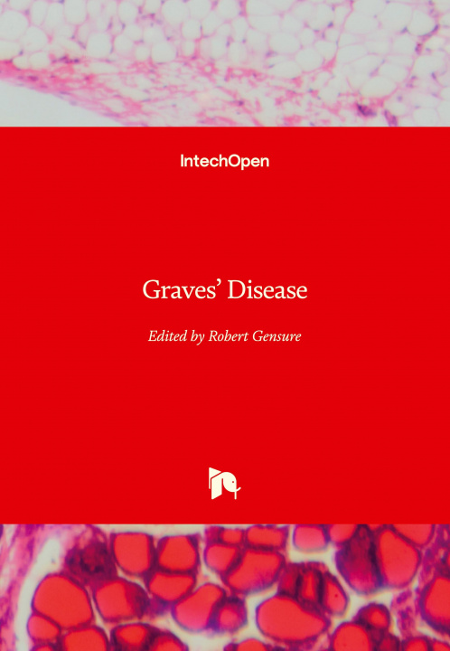 Książka Graves' Disease 