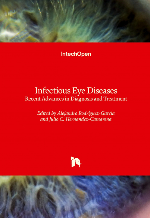 Kniha Infectious Eye Diseases Julio C. Hernandez-Camarena