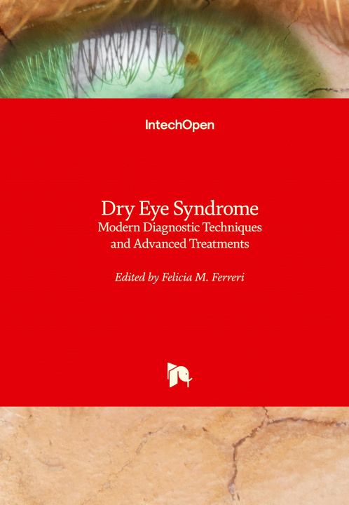 Książka Dry Eye Syndrome 