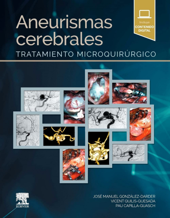 Kniha Aneurismas cerebrales 